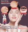 Hell Pore Control Hyaluronic Acid 97%