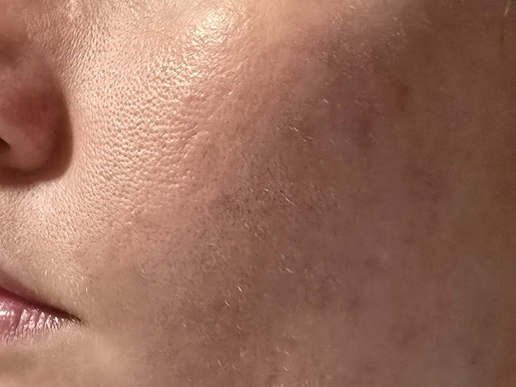 Before image of cheek before mask application