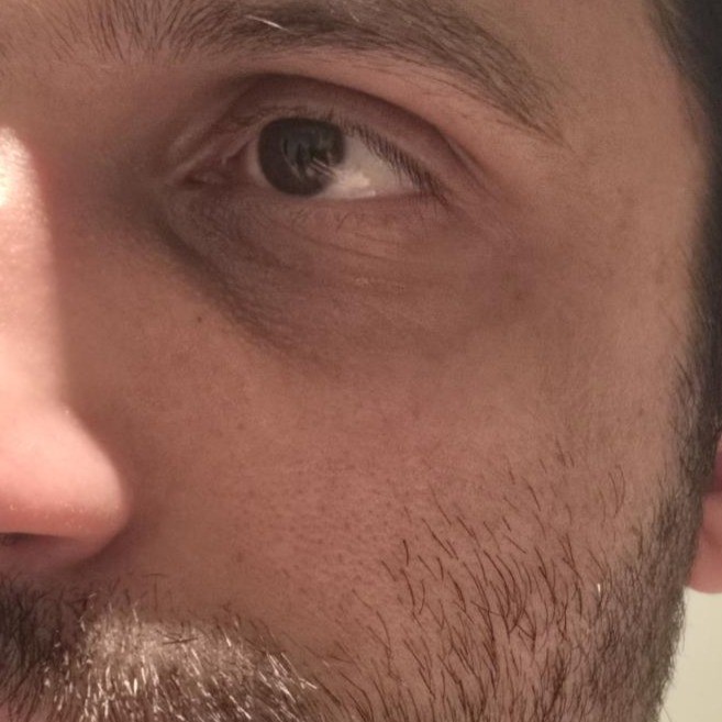 Before Celimax Vita-A Retinol Tightening Serum Testing