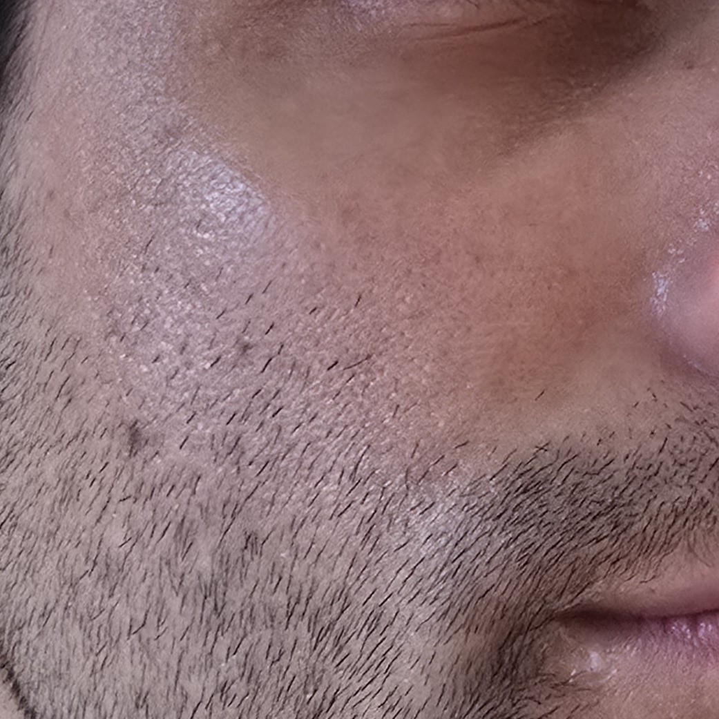 Skin after using Dr Althea ABC Glow Whipped Serum
