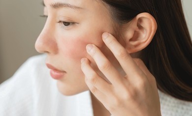 Young asian woman touching her cheek, which is red with irritation