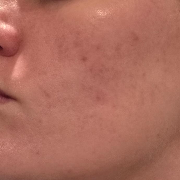 Elizavecca Botanitch Hydrogel Collagen Recipe Mask Pack