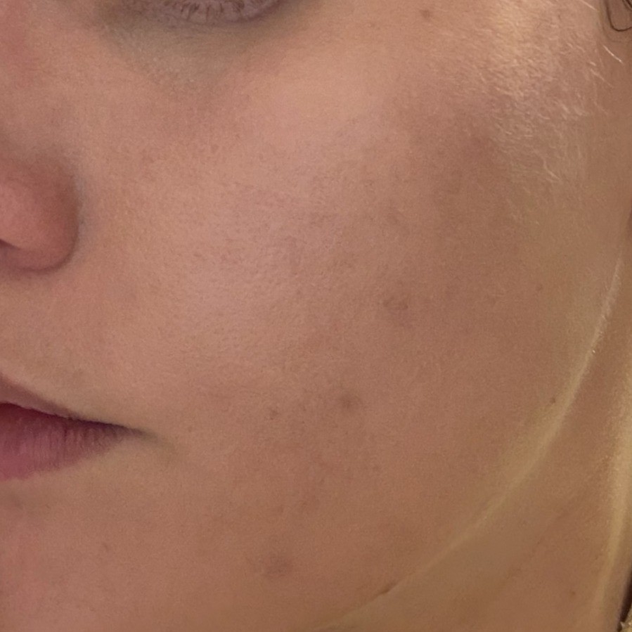 Blanc Cover Cream Stick Medium After Blending