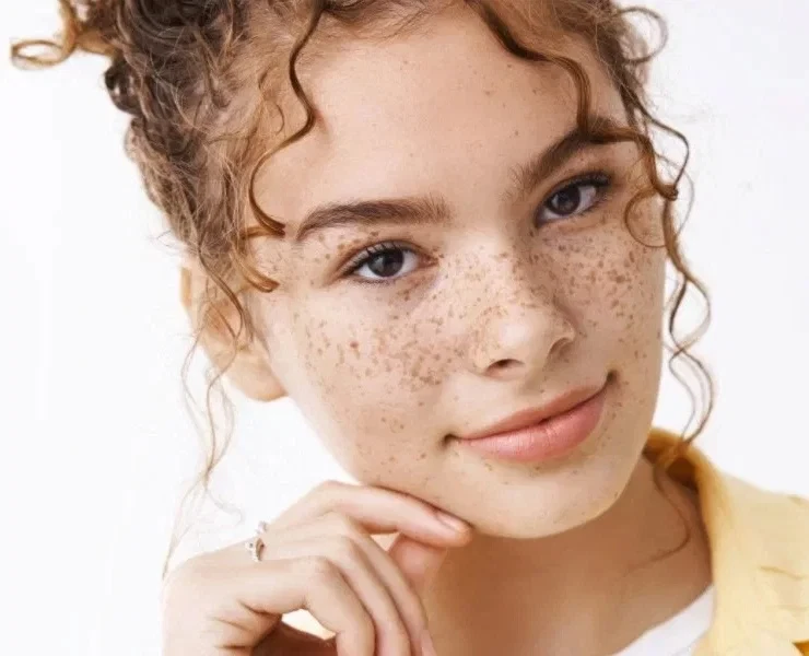How to Treat Hyperpigmentation