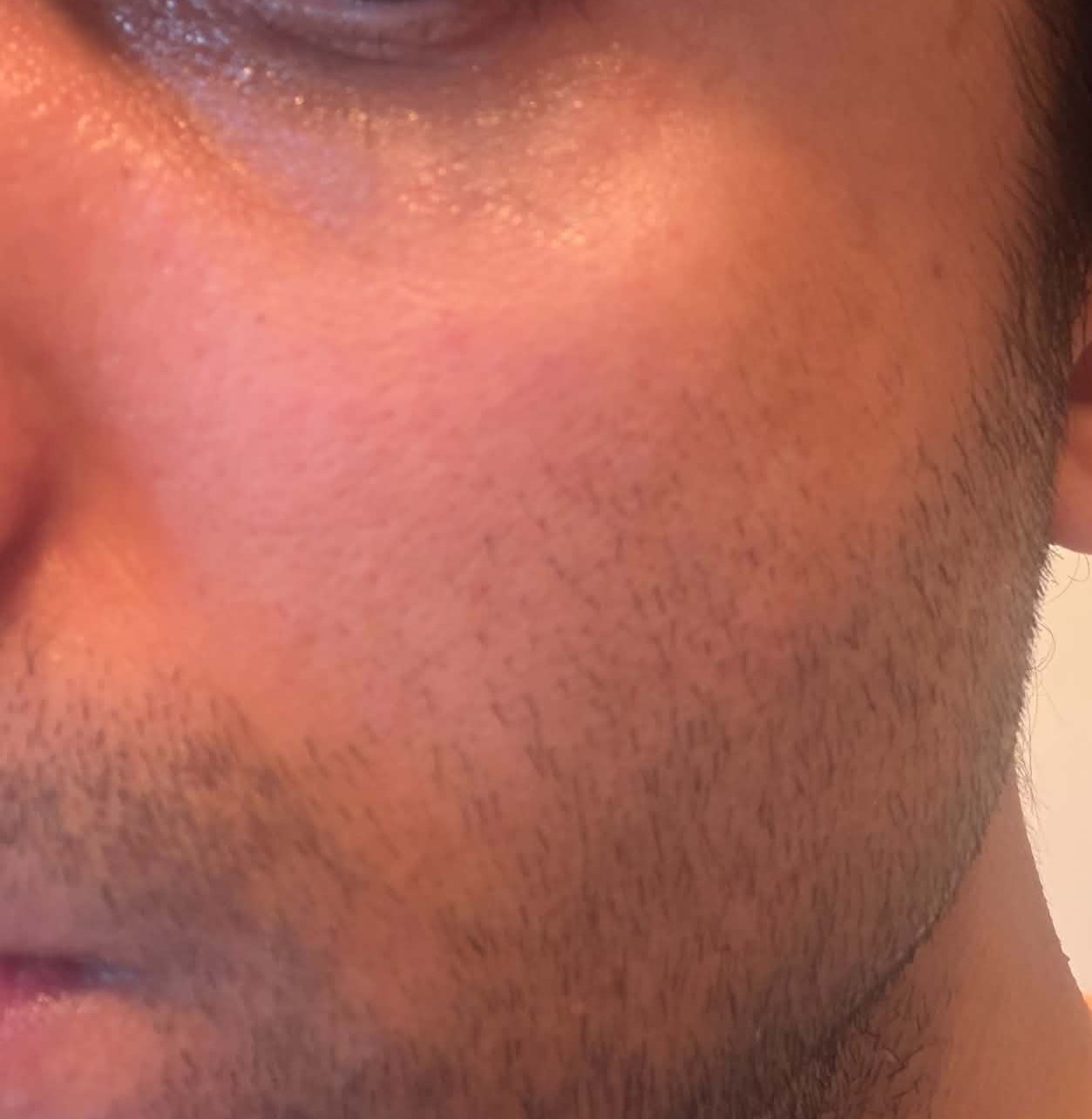 Skin After Numbuzin No.3 Bifida Bakuchiol Zero Pore Serum 30ml