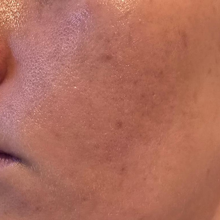 Skin1004 Madagascar Centella Probio-Cica Glow Sun Ampoule