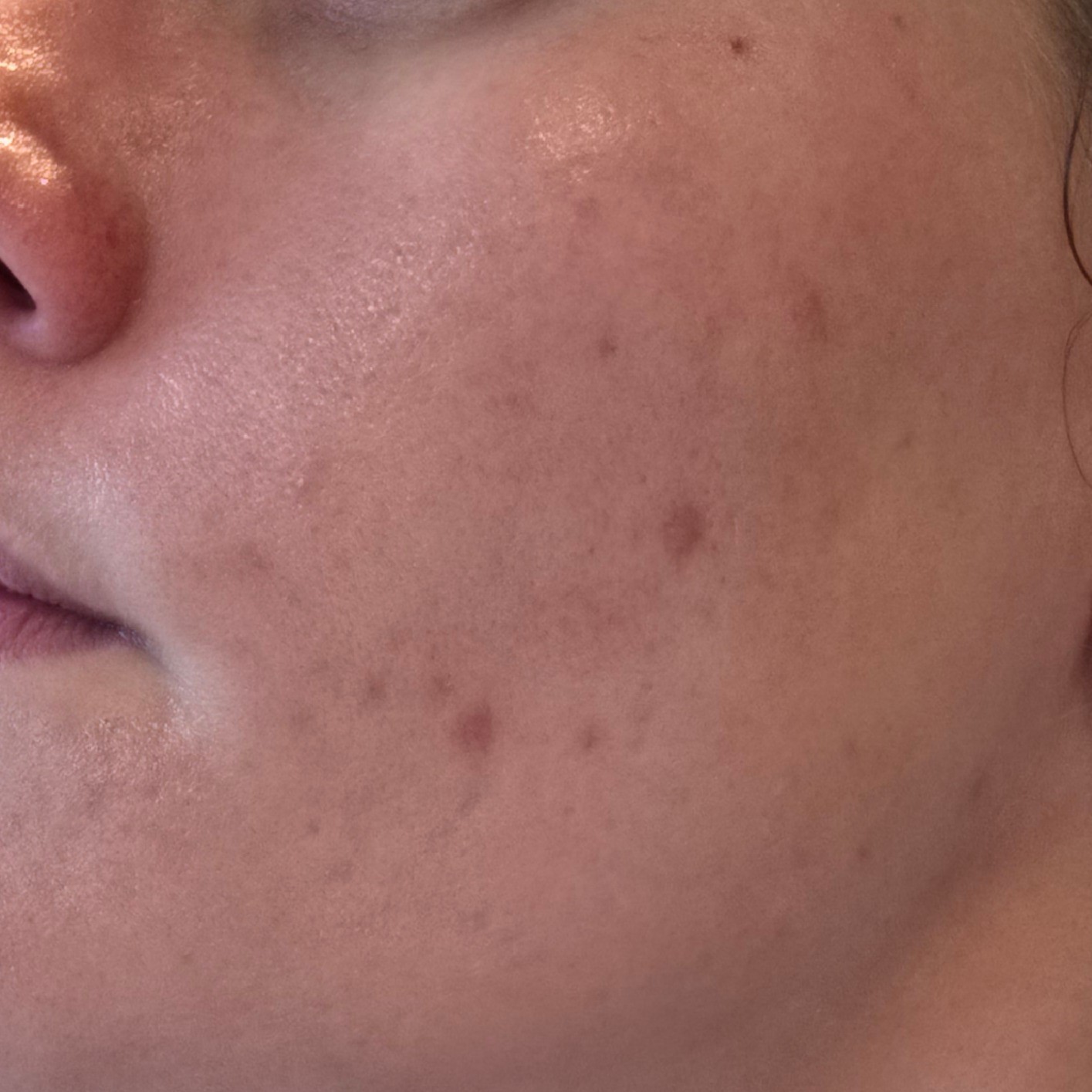 Before using Some By Mi Retinol Bakuchiol Bubble Toner