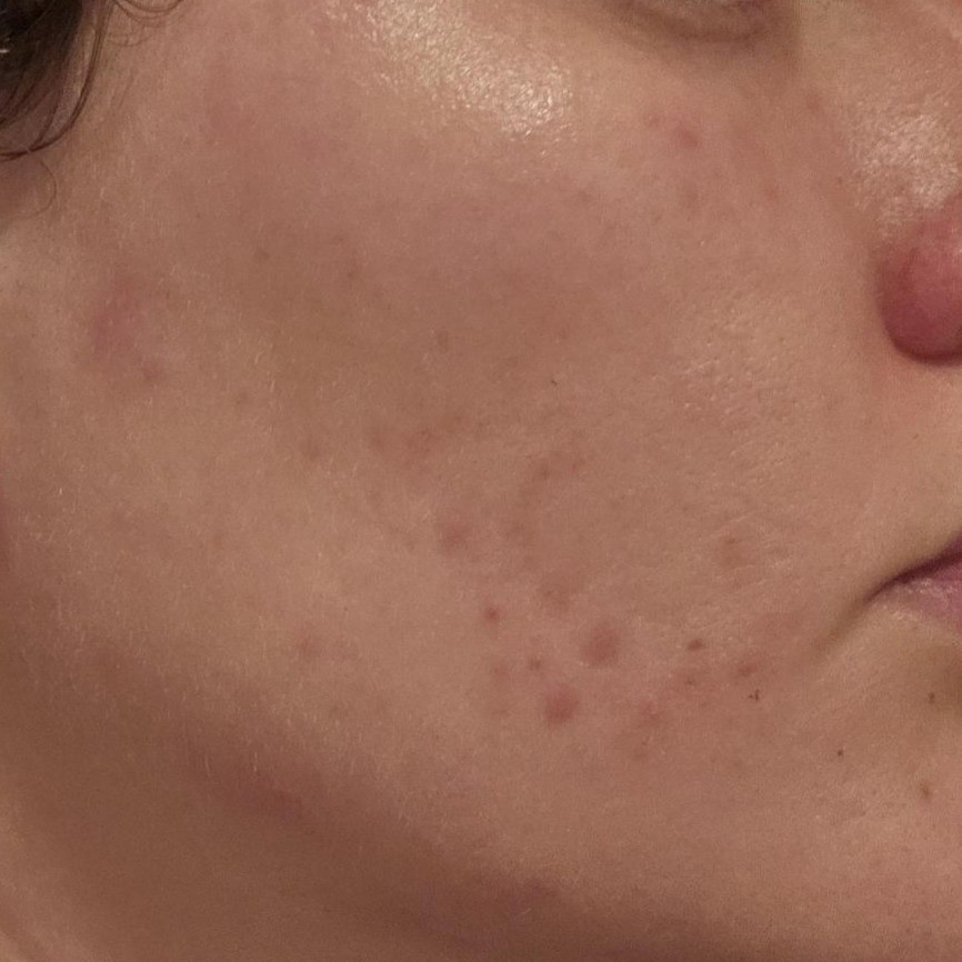 Skin After using Abib Bright Force Serum