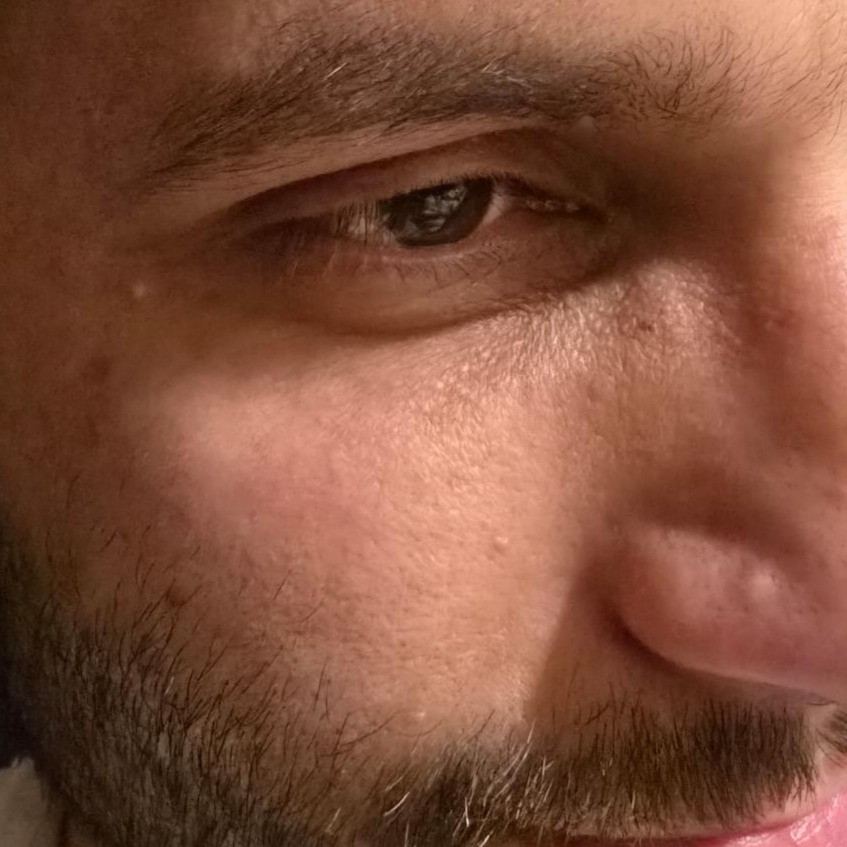 After Celimax Vita-A Retinol Tightening Serum Testing