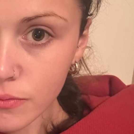 Skin after using Mary&May Collagen Peptide Vital mask