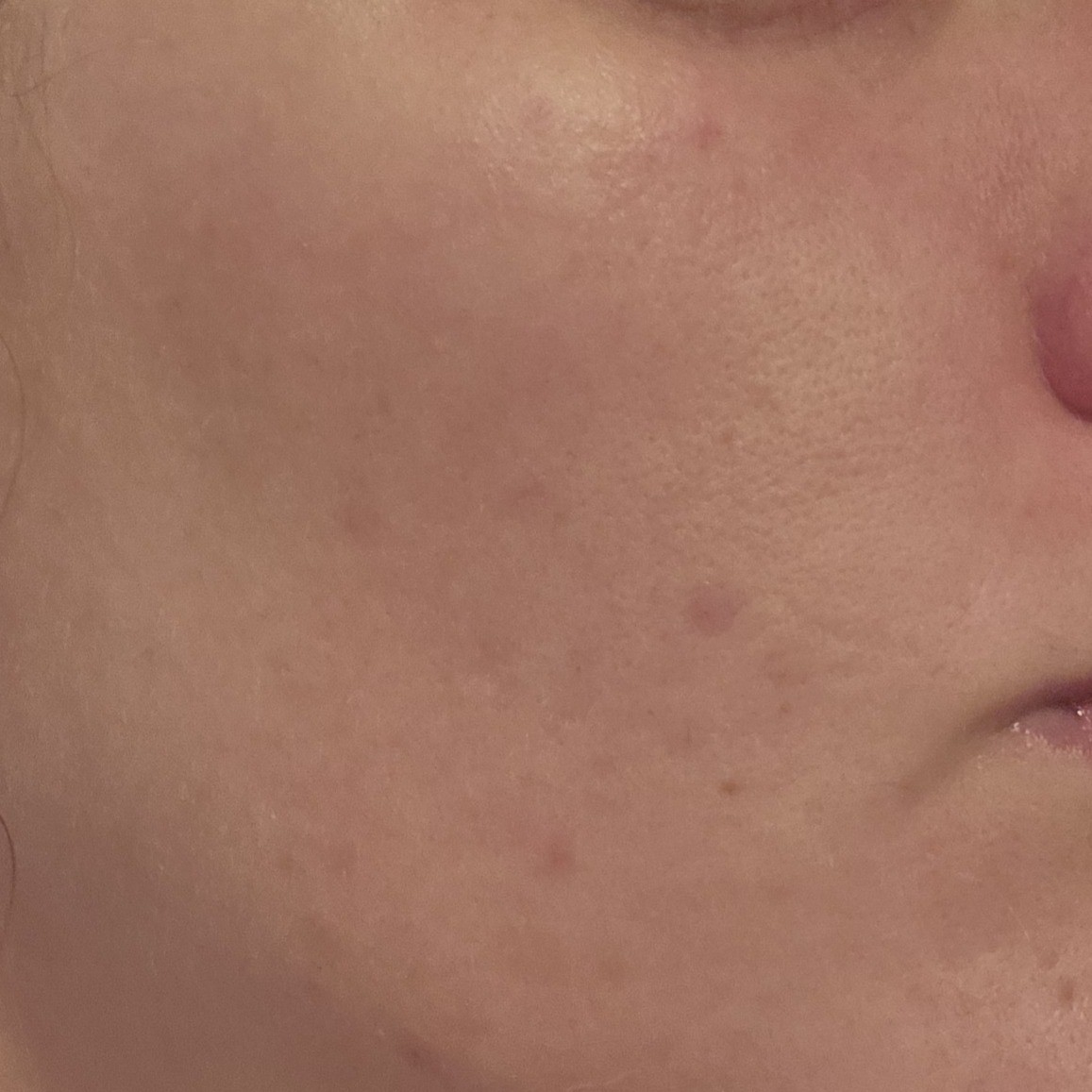 After using Skinfood Rice Mask Wash Off Pack