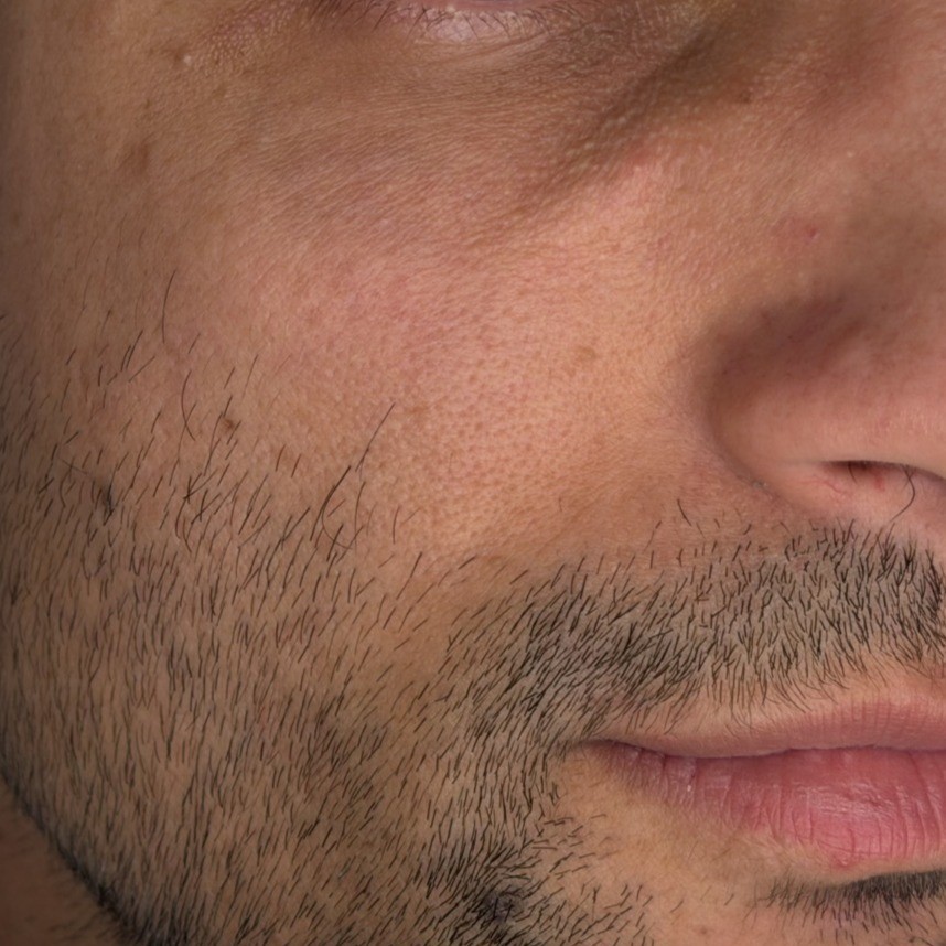 After using Centellian24 Madeca Cream Time Reverse