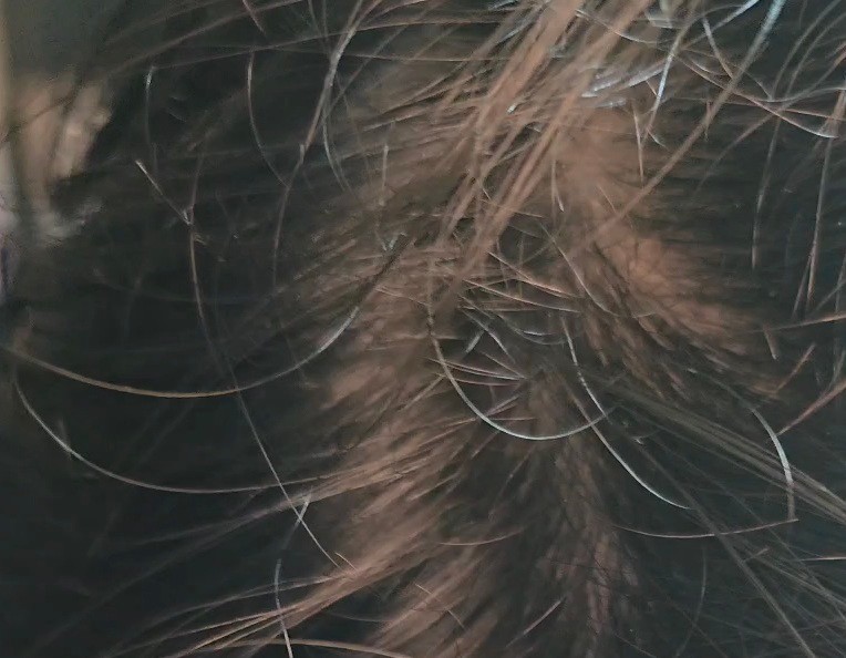 Scalp Before Using Aromatica Trial Kit