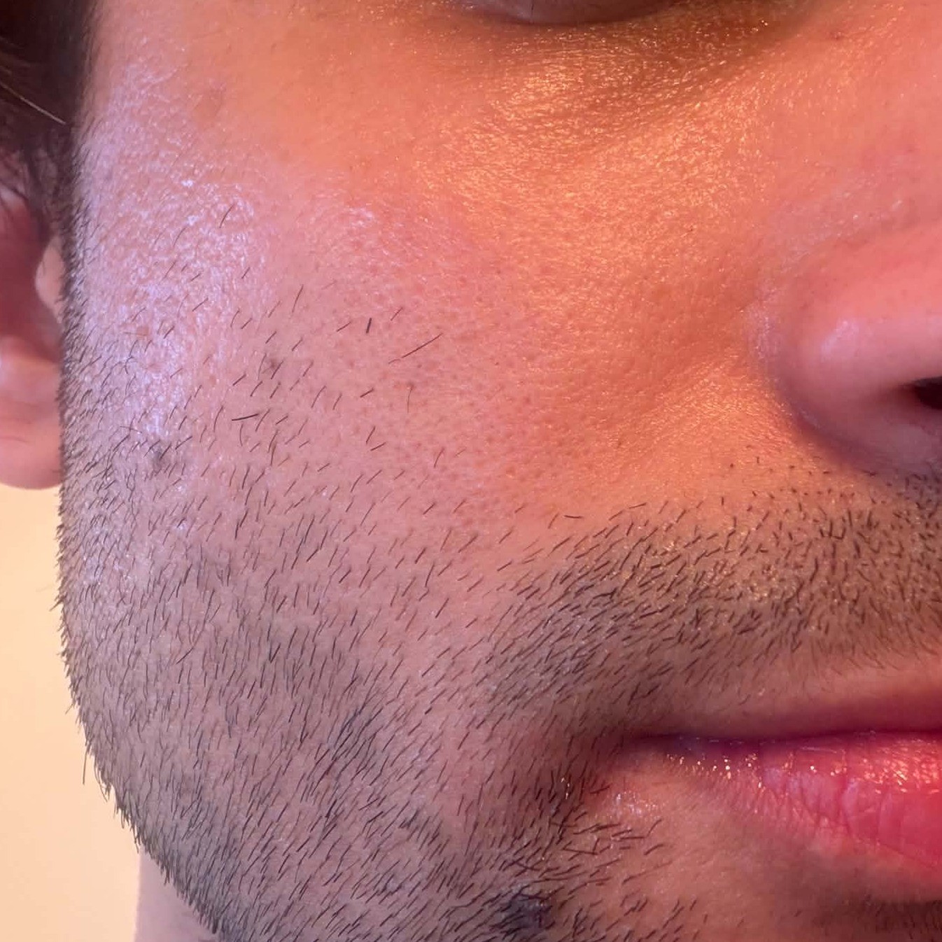Cheek After Using Medicube PDRN Peptide Balm