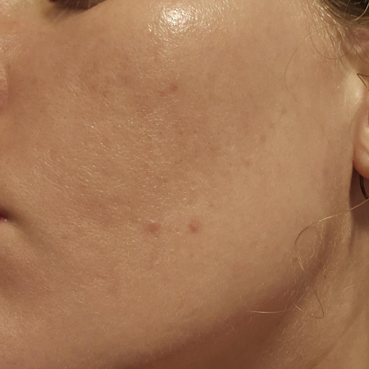 Close-up after using Abib Dark Spot Collagen Wrapping Mask