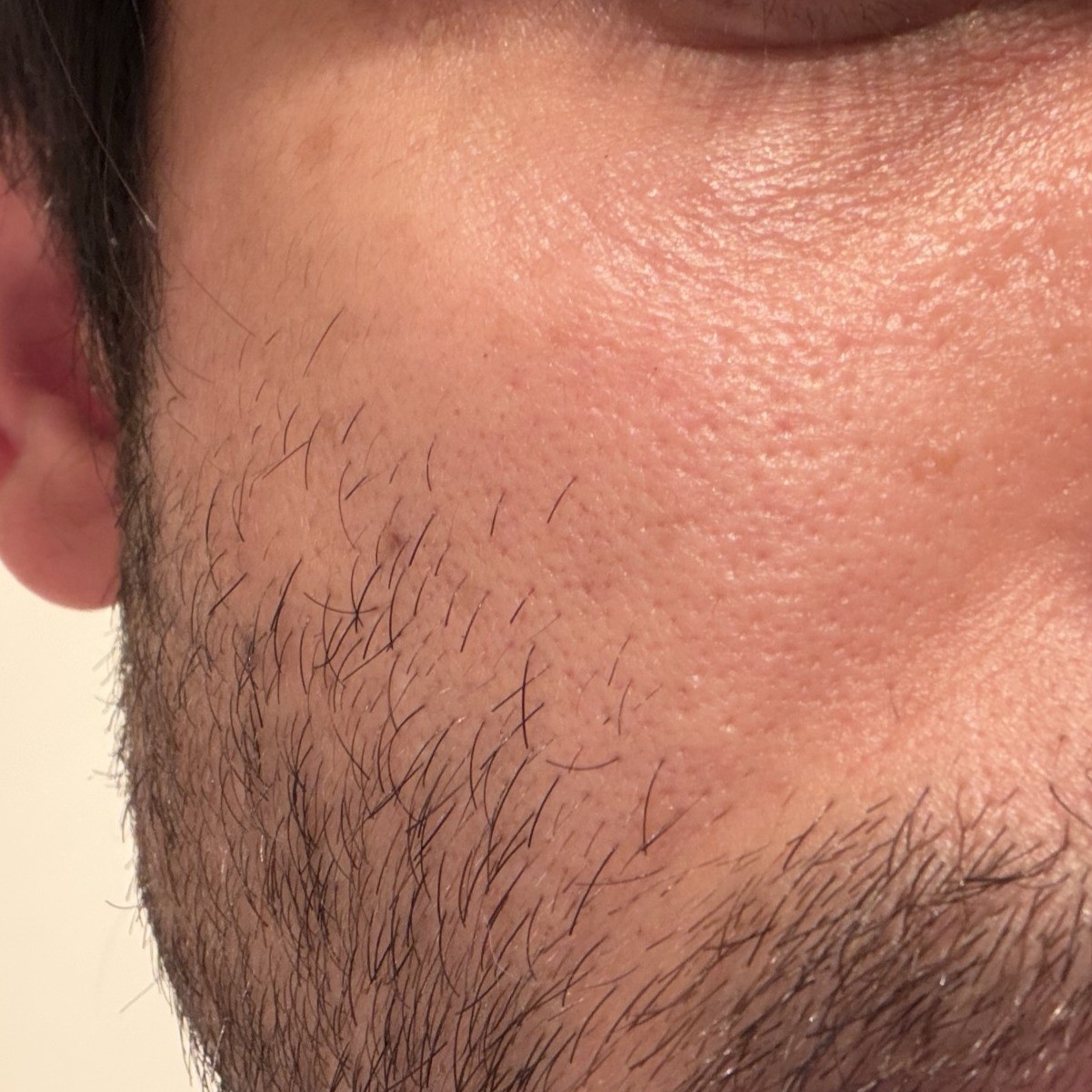 Skin after using Dr Althea 345 Barrier Cream