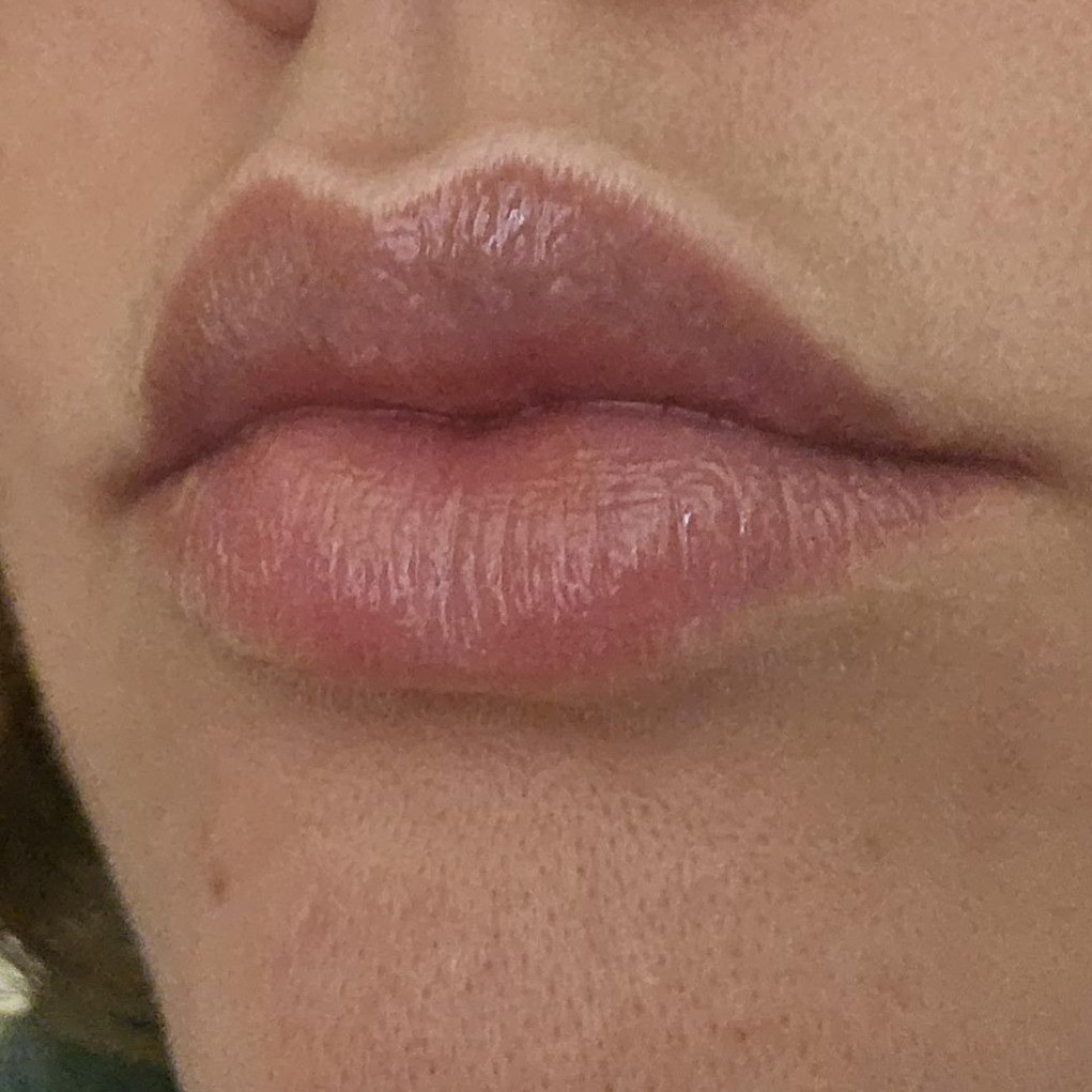 Close-up (After Pic) hydrated and rosy-colored lips
