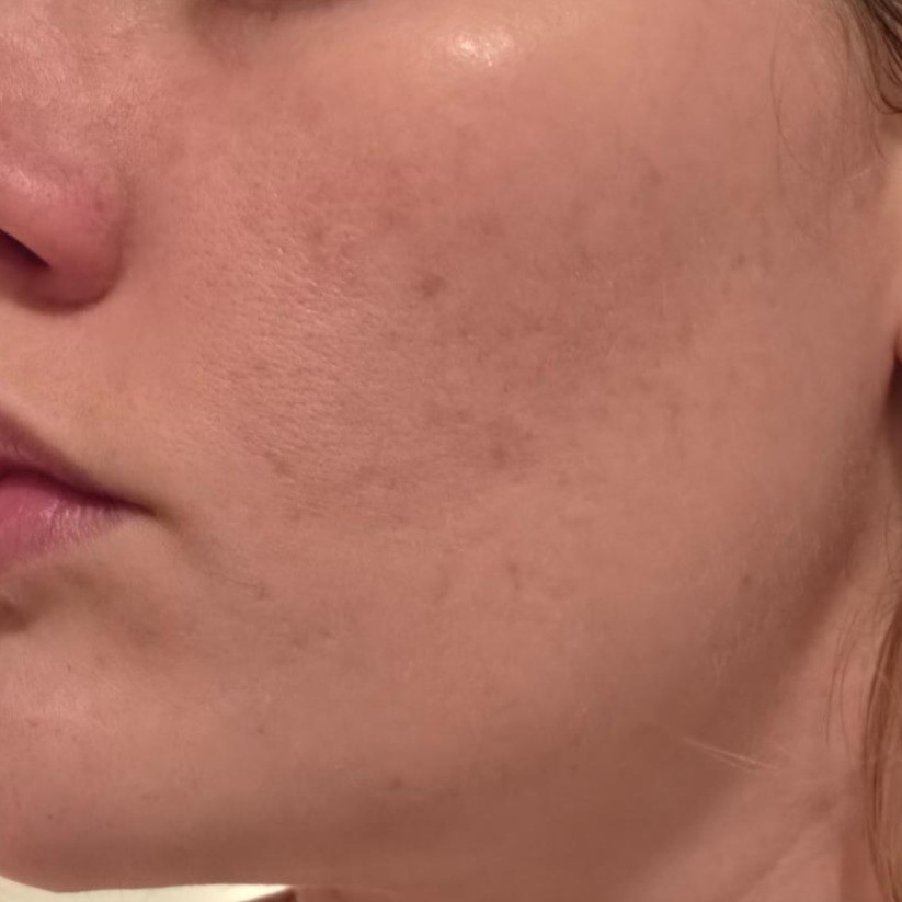 Before using Elizavecca Botanitch Hydrogel Collagen Recipe Mask Pack