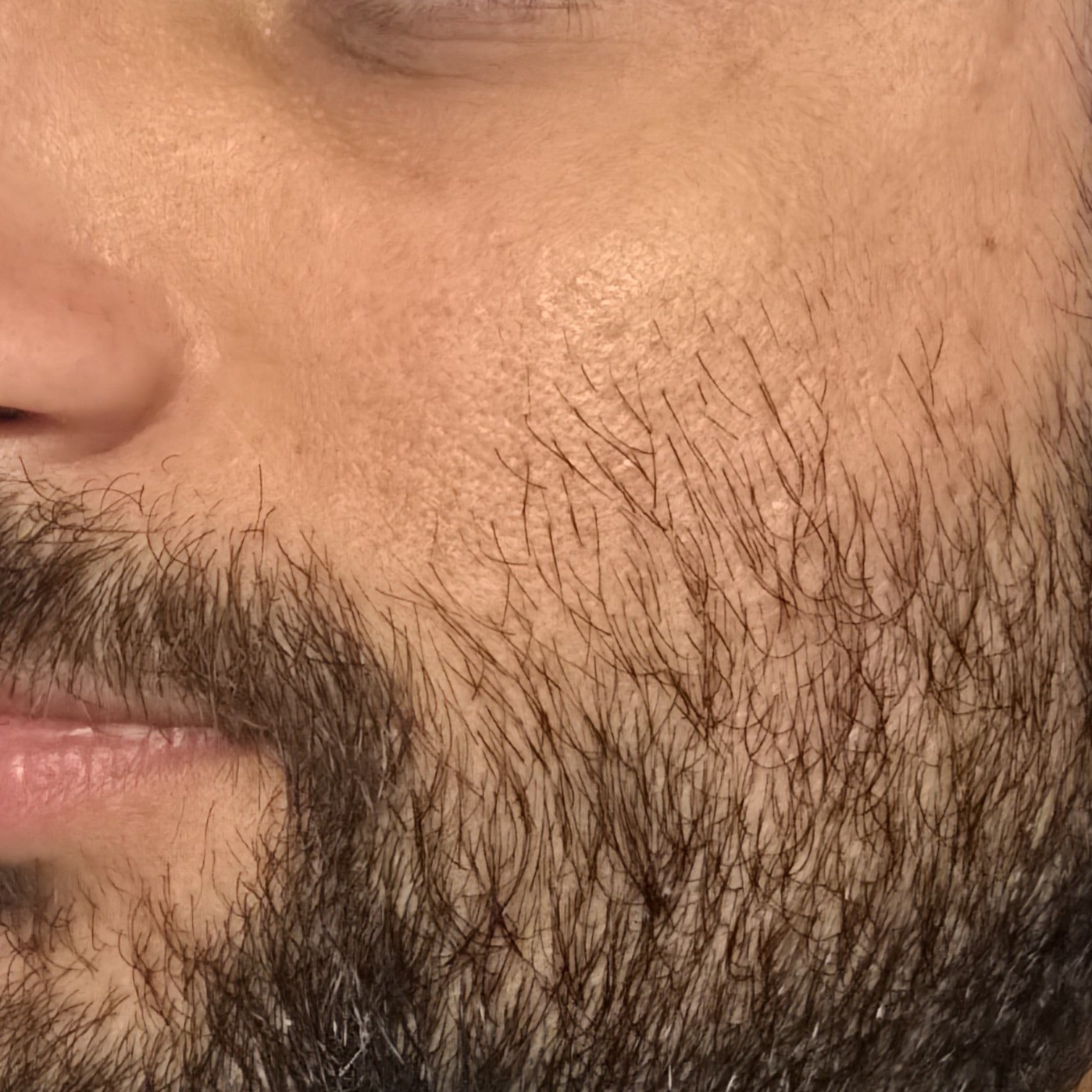 Skin before using Frankly PDRN Bounce Ball Serum