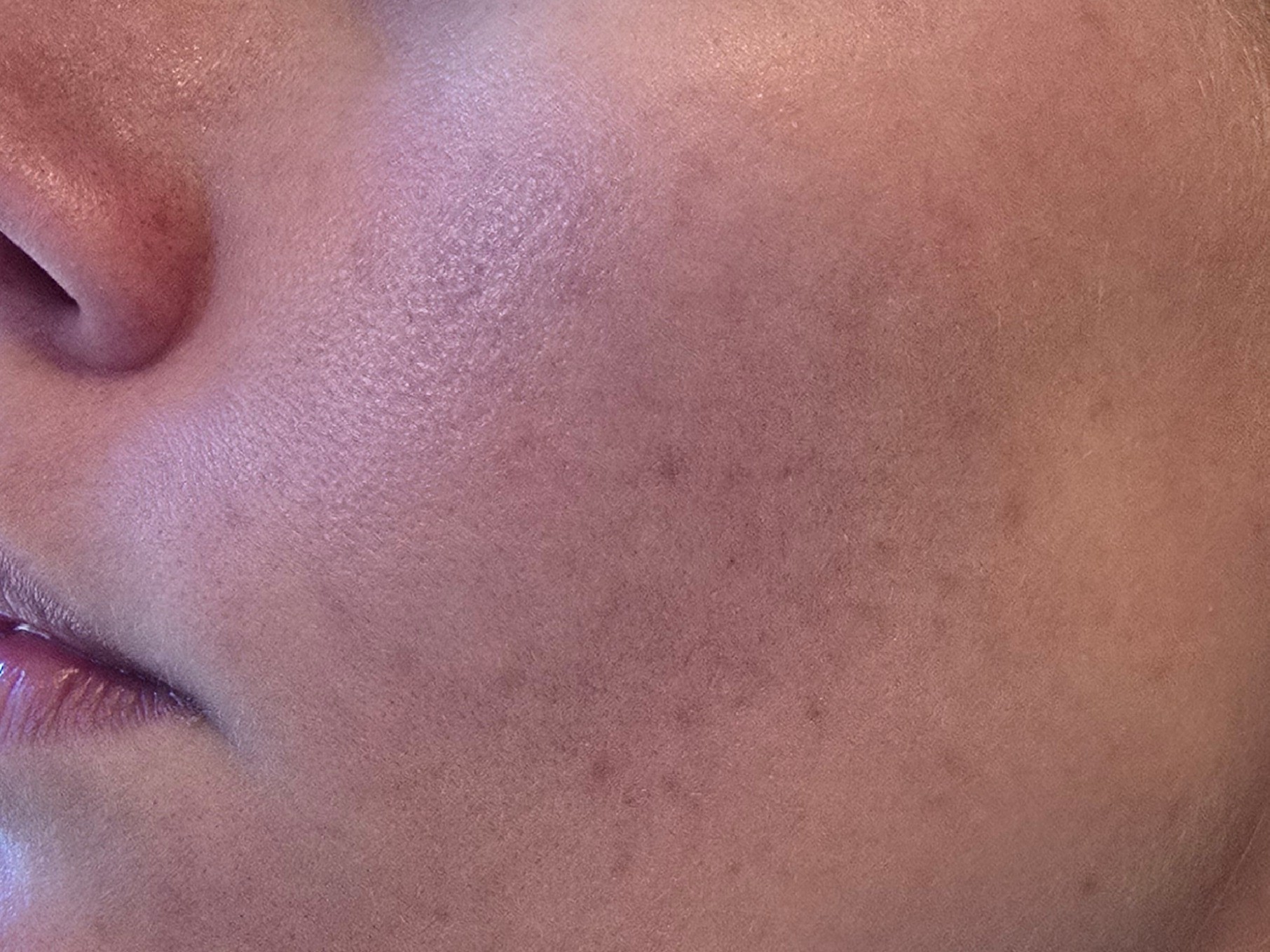 After image of mask application showing firmer, more taut skin