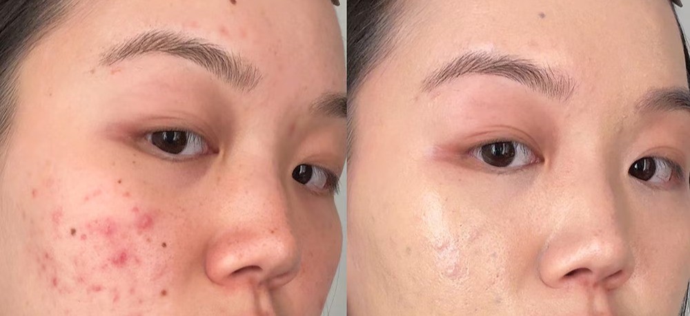 Dr Jart+ Official Cicapair TIger Grass Color Correcting Treatment Promo Images