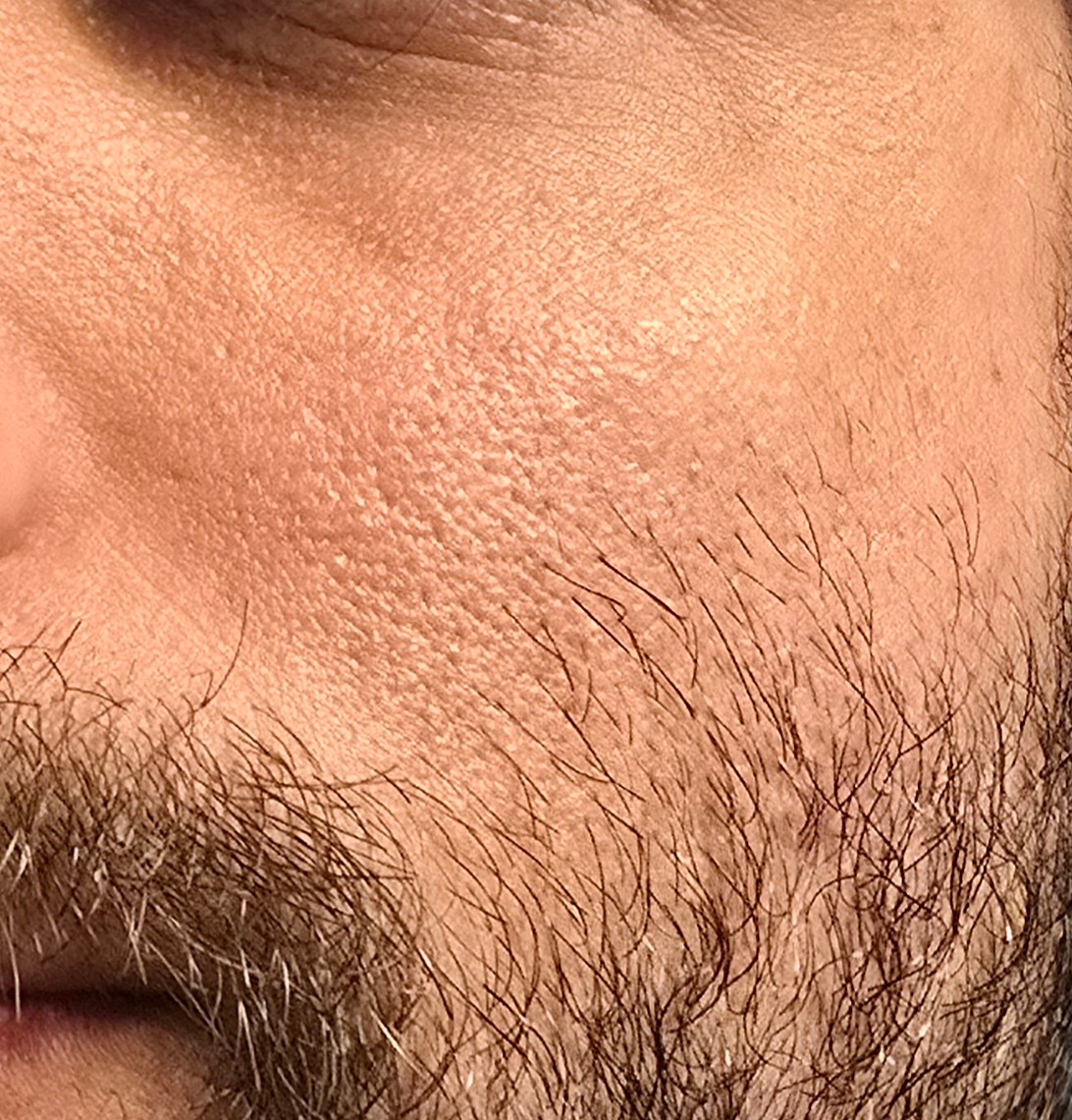 Face before using Purito Seoul Oat In Calming Gel Cream