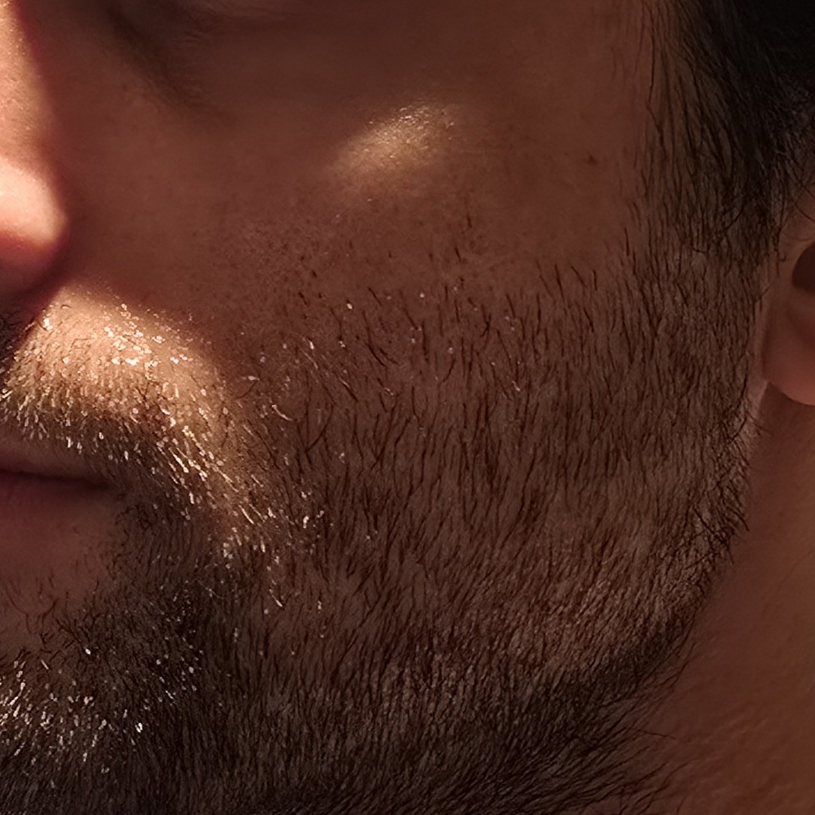 Left cheek after using Ultimate Beautician Gift Set