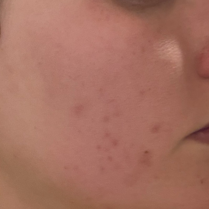 Plain Skin Before using Blanc Cover Cream Stick Medium