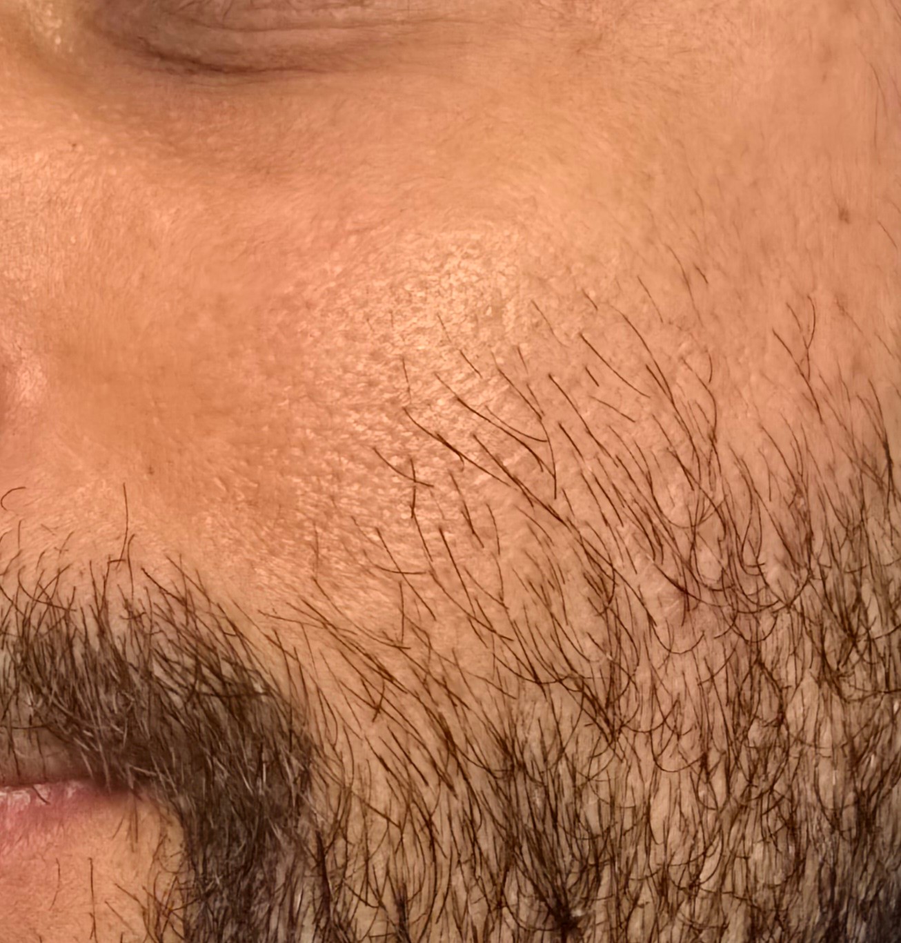 Face after using Purito Seoul Oat In Calming Gel Cream