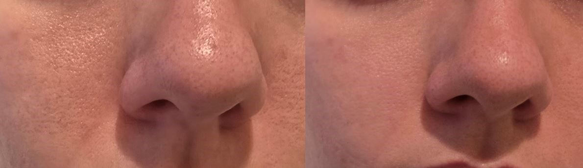 Before and After Beauty of Joseon Matte Sunstick Effect Nose