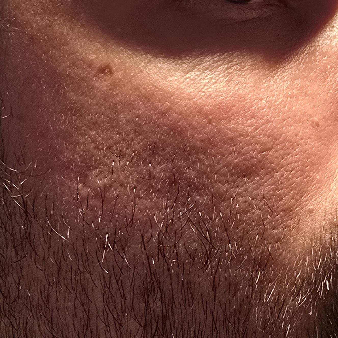 Skin after using Skin1004 Ampoule