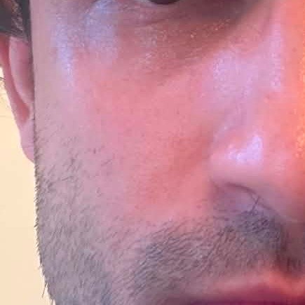 Skin Before Using Abib Glutathione Dark Spot Pad
