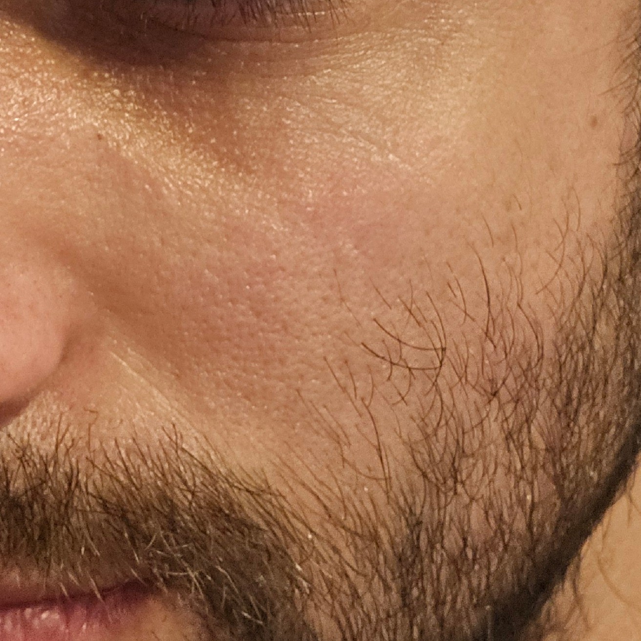 Skin texture before using K-Secret Seoul 1988 Boosting Serum Collagen Complex 7 + Red Ginseng
