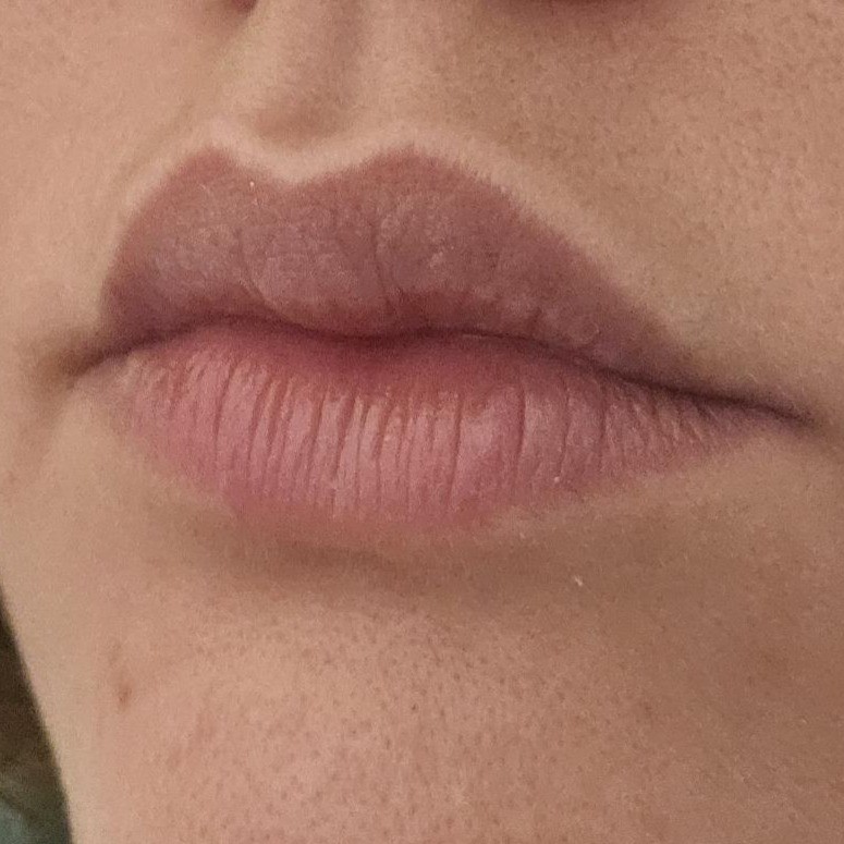 Close-up (Before Pic) dried, chapped lips with pale color