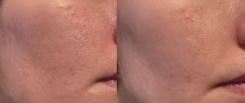 Before and After Beauty of Joseon Matte Sunstick Effect Cheek