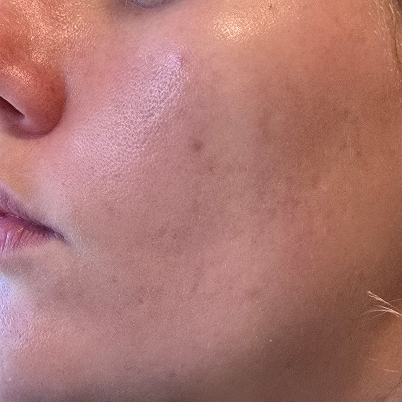 Skin before Some By Mi Sherbet Face Mask