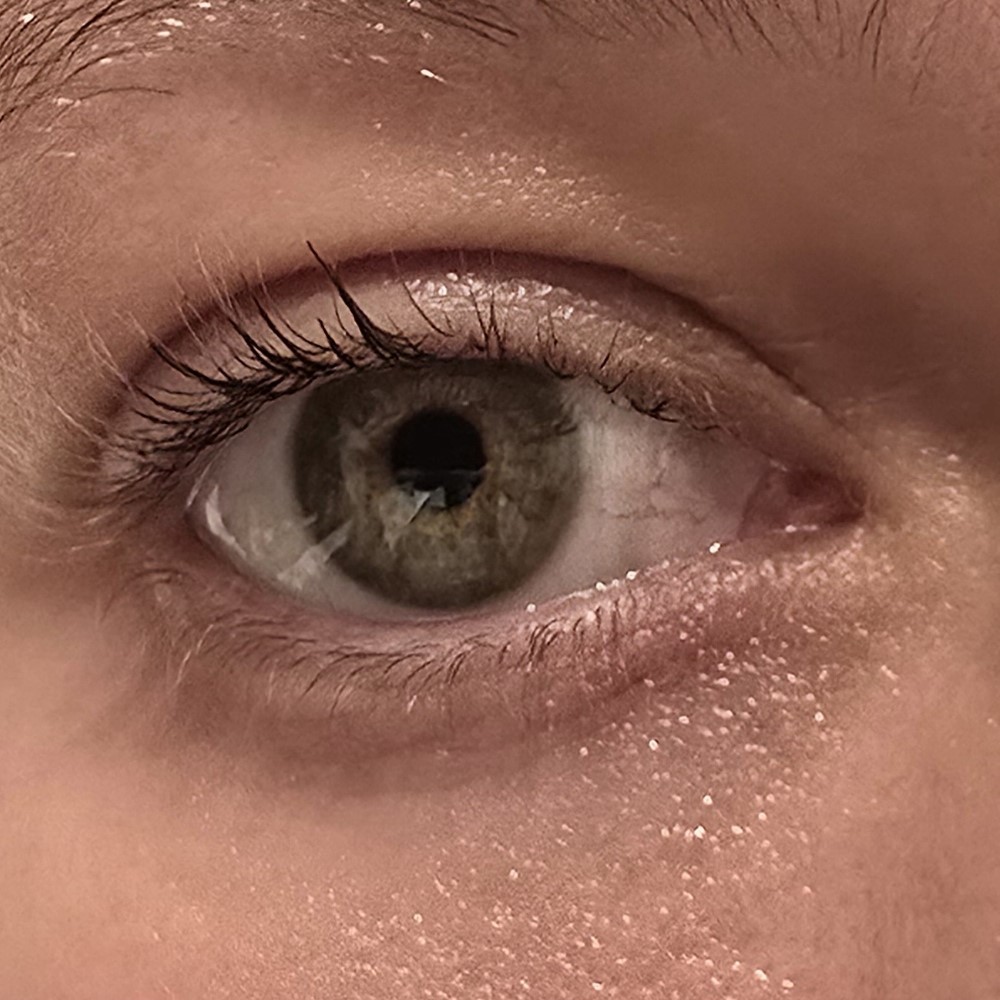 After image of eye - after Beauty of Joseon Eye Serum